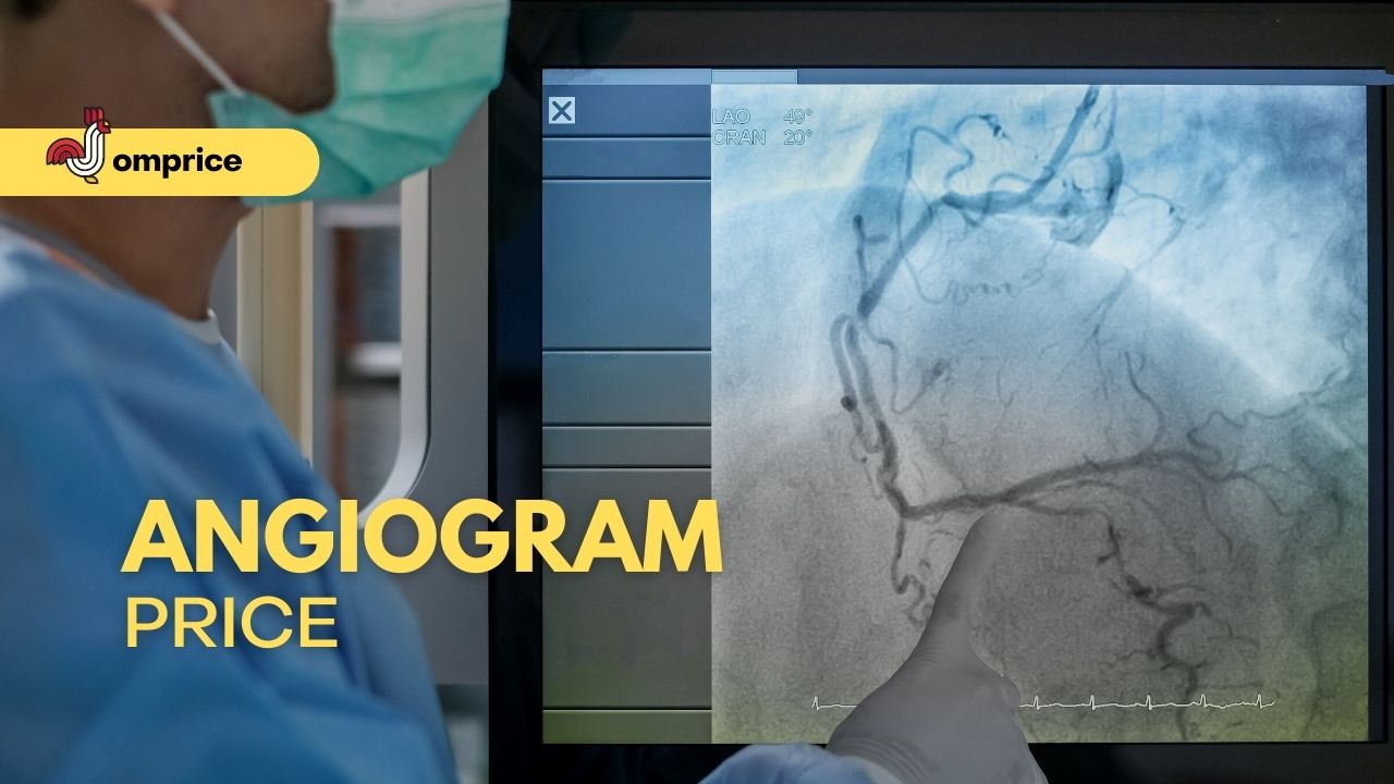 √ (Update) Angiogram Price Philippines and Types 2024