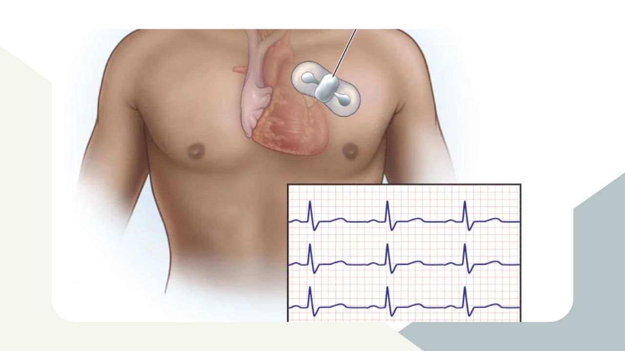 ecg-test-price-philippines-2024