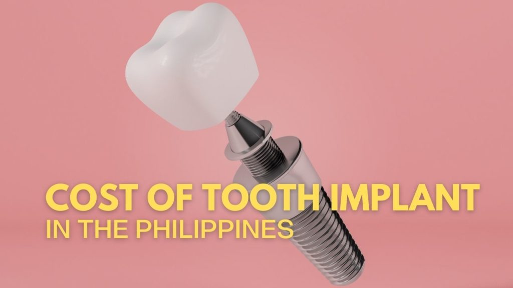 All Dental Care Price List in Philippines 2023