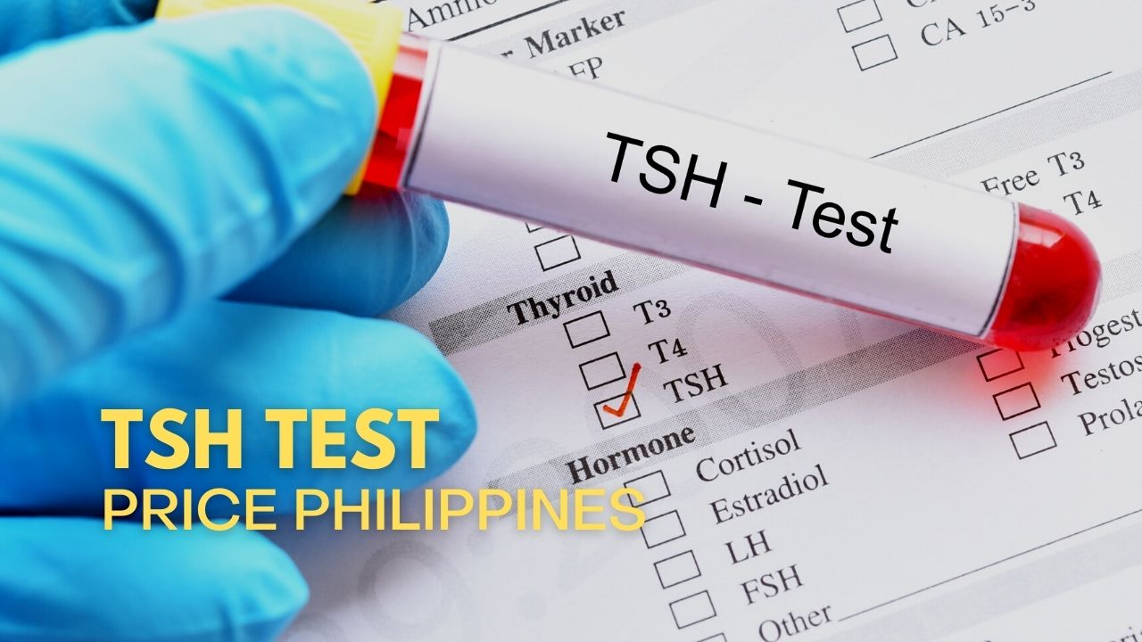 tsh-test-price-philippines-hospitals-2023