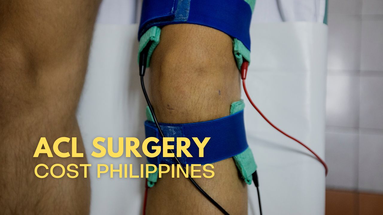 acl-surgery-cost-philippines-free-surgery-option-2024